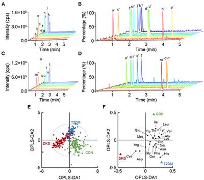 Metabolomic Profiling of Amino Acids in Human Plasma Distinguishes Diabetic Kidney Disease From Type 2 Diabetes Mellitus